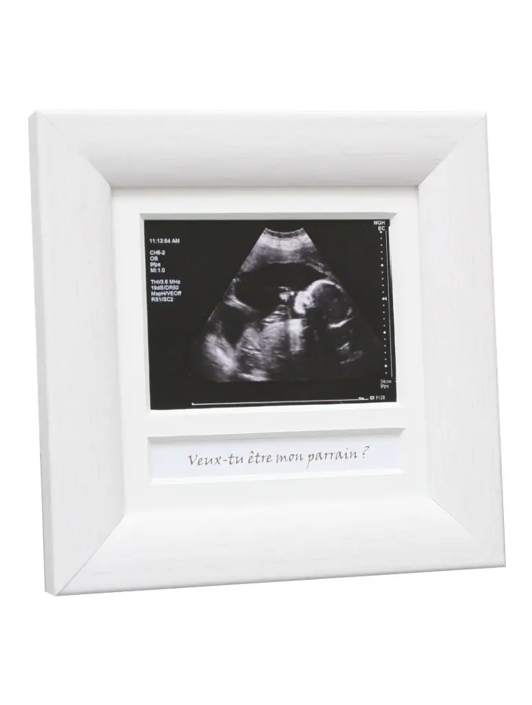 [S54SEF] CADRE BLANC 10X10 POUR ECHO